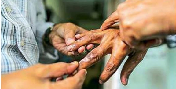 रायगड जिल्ह्यात ३८८ कुष्ठरुग्ण